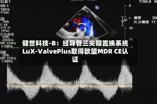 健世科技-B:经导管三尖瓣置换系统LuX-ValvePlus取得欧盟MDR CE认证